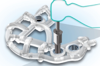 Propojení s CBCT