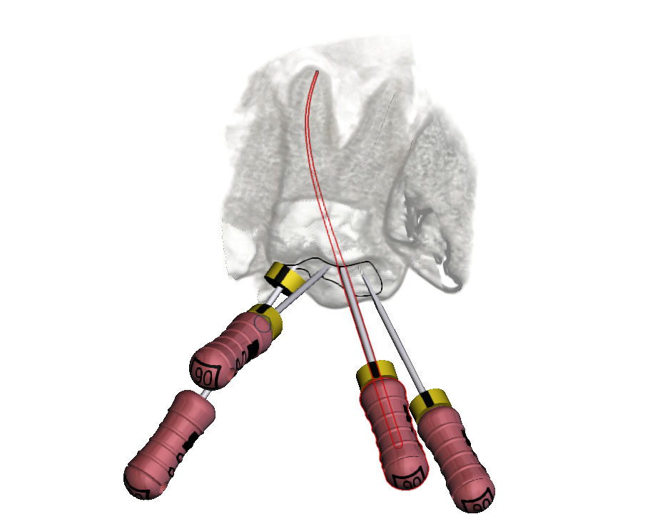 Propojení s CBCT